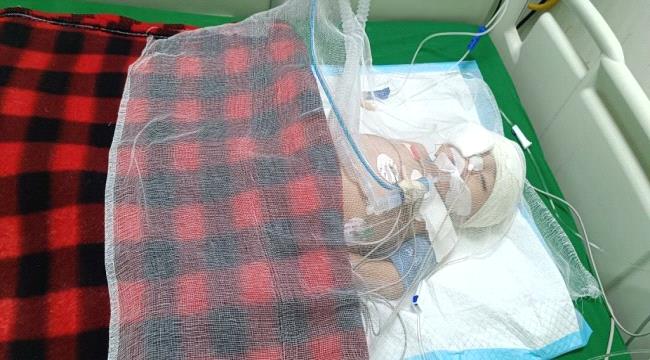 
                     محافظ عدن يتكفل بعلاج طفلة أصيبت برصاص راجع برأسها في جعار