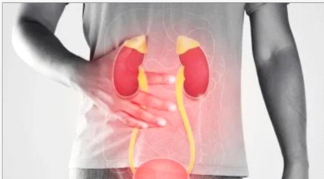 يكشف تلف الكلى مبكرًا قبل ظهور الأعراض.. ما هو تحليل UACR