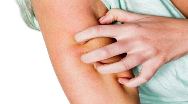 عارض خفي لمشكلات في الكبد ...