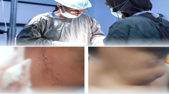 نجاح عملية جراحية لاستئصال ورم في الرقبة بمستشفى عدن التعاوني الخيري ...