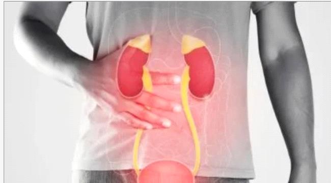 كيف تحمي نفسك من عودة حصوات الكلى؟ .. 6 خطوات للوقاية ومتى يجب مراجعة الطبيب