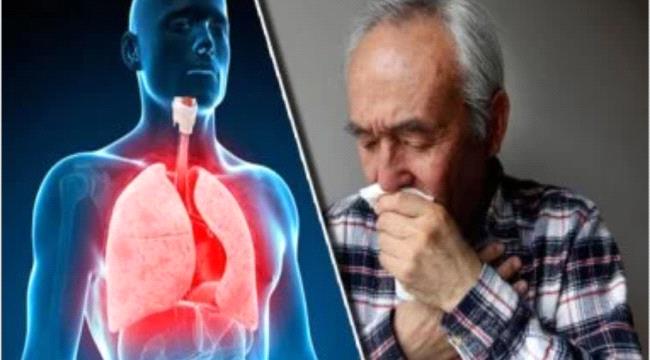 التهاب الشعب الهوائية الحاد.. أعراضه وأسبابه وطرق العلاج